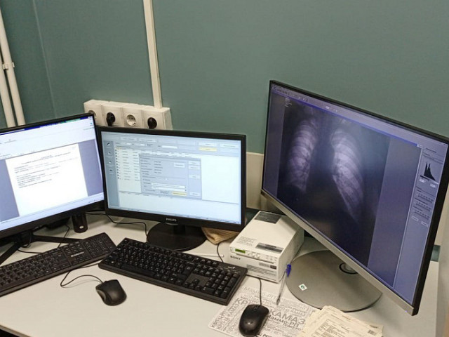 «Первичное звено»: 5 цифровых флюорографов поступили в поликлиники региона